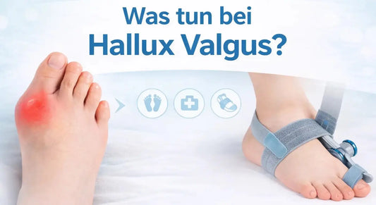 Was tun bei Hallux Valgus?