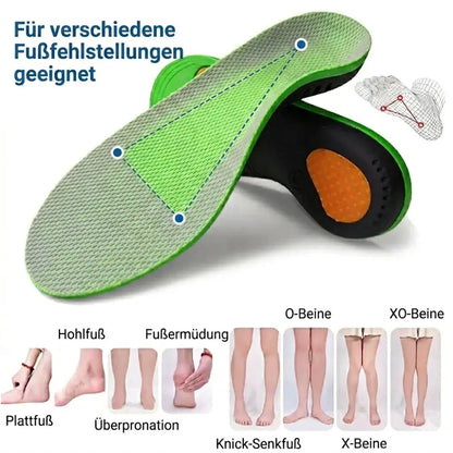 Einlagen Plantarfasziitis – Fußfehlstellungen und Indikationen