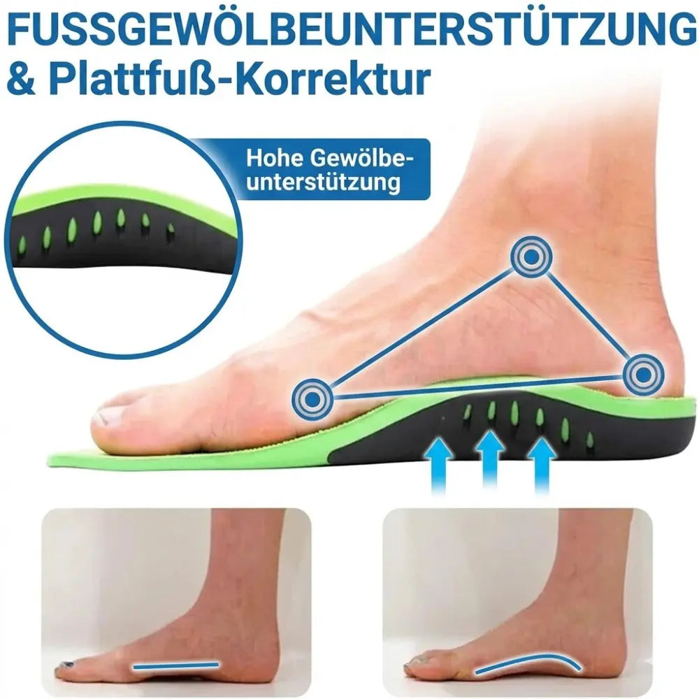 Einlagen Plantarfasziitis – Gewölbeunterstützung und Plattfuß-Korrektur