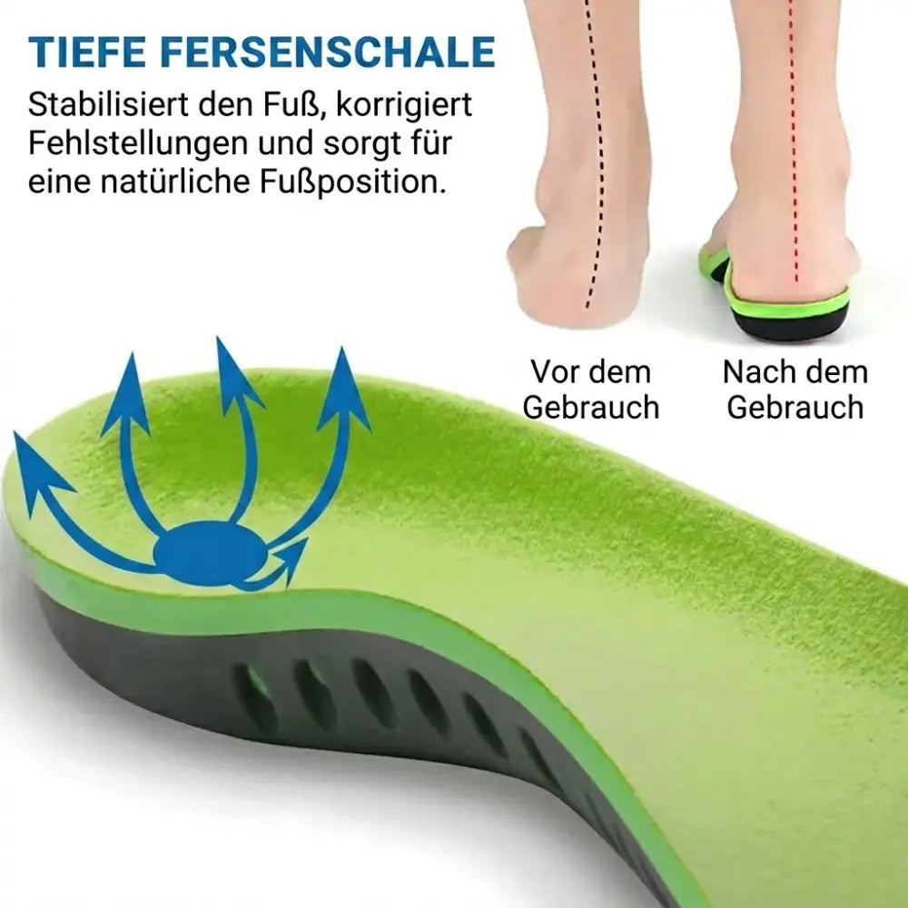 Einlagen Plantarfasziitis – Tiefe Fersenschale Vor und Nach