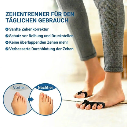 Zehentrenner Silikon täglich getragen – Vorher Nachher Zehenkorrektur und Schutz vor Druckstellen