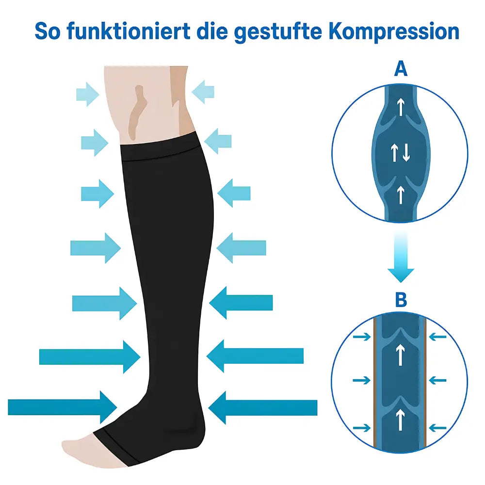 funktionsweise gestufte kompression am bein schema