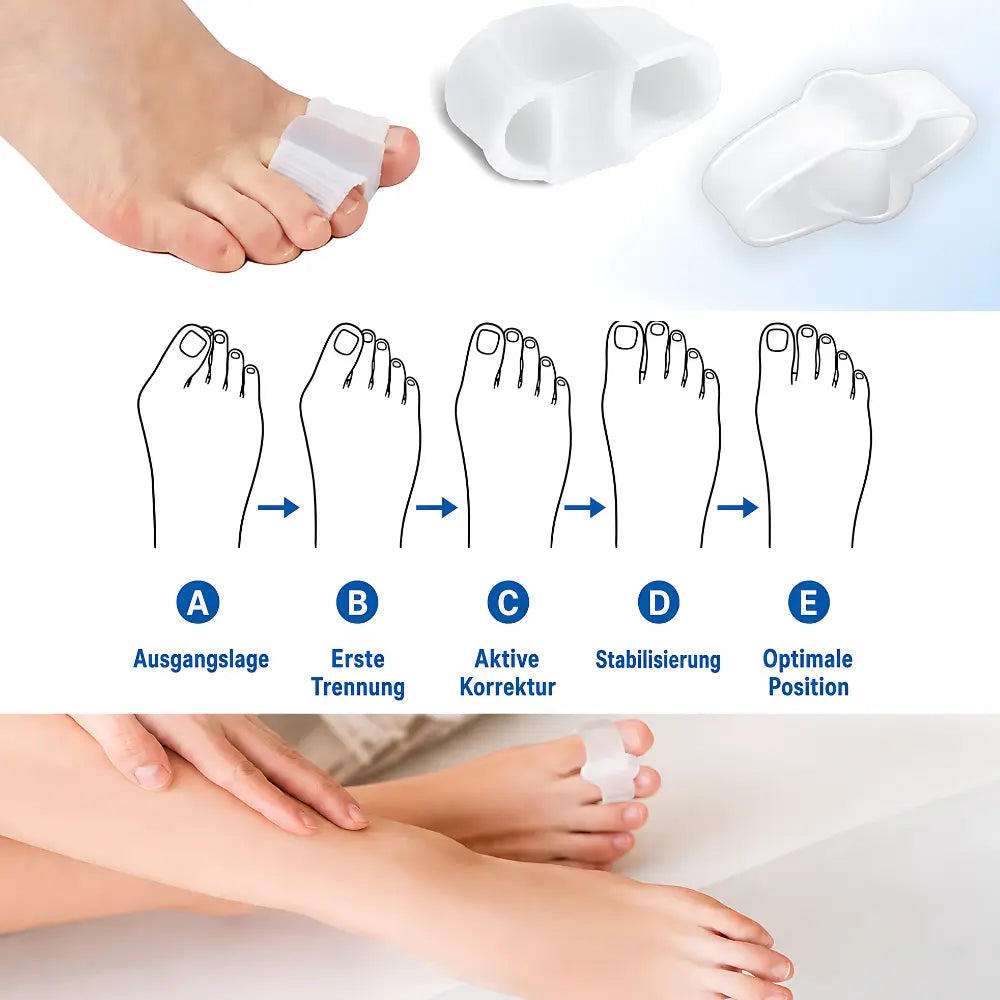 zehenspreizer hallux valgus mechanismus fuenf schritte ausrichtung